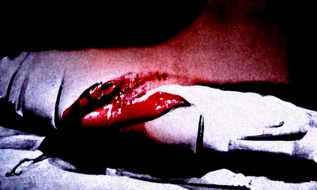 Love is a wound
