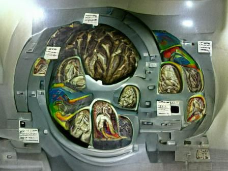 Detailed MRI Brain Scan Visualization