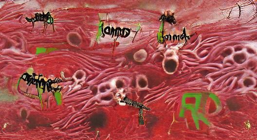 Disturbing Image of Rancid Amputation