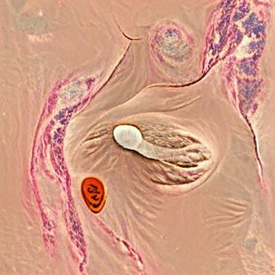 Breast Parasite Image