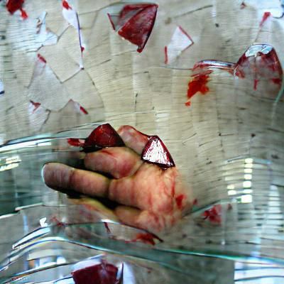 Bleeding Hand Cut by Broken Glass