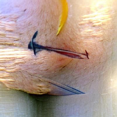 Arrow Piercing Knee: A Direct Visual