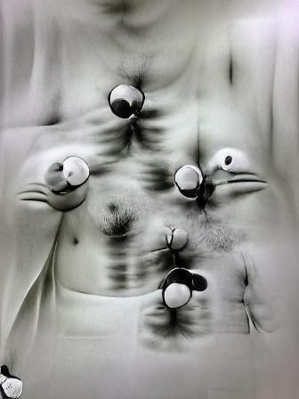 Man with Four Nipples - Black and White Medical Photo