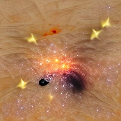 Stars Orbiting a Black Hole