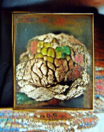 Expressionistic Brain with Warts in Naive Style