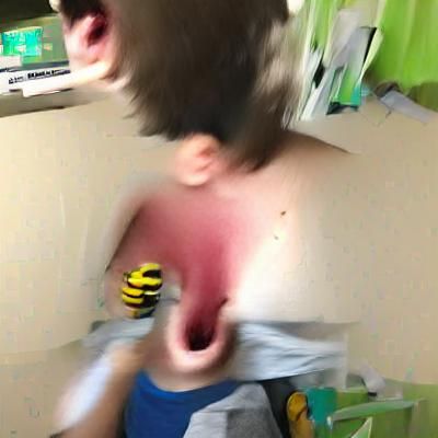 Child's Reaction to Bee Sting