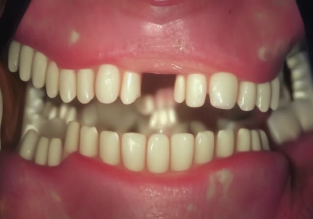 Skulls Substituted for Teeth in Surreal Composition