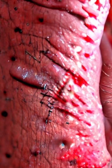 Gangrenous Wound: A Study in Decay