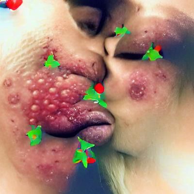 Herpes Is The Gift That Keeps On Giving - Text Art