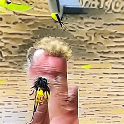 Wasp Sting on Finger of Tall Man