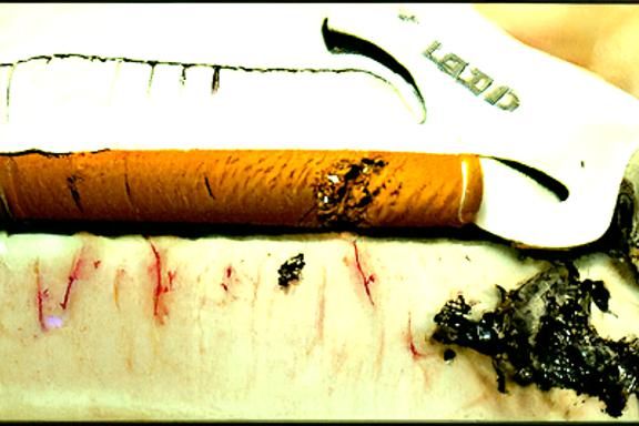 relapse leads to smoking lead to cutting leads to getting cl...