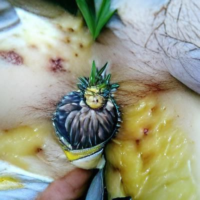 Surreal Pineapple Growth on Human Skin