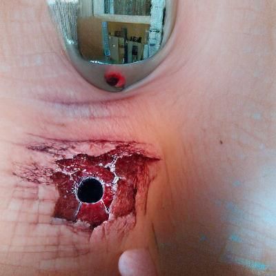 bloody hole in person