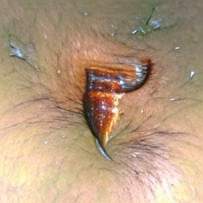 Dormando