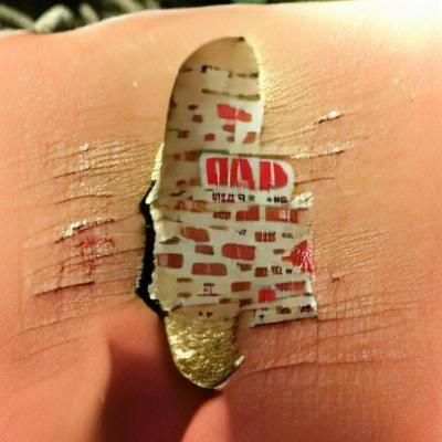 sometimes you have to rip the band aid off and see what happ...