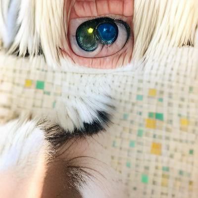 Heterochromia