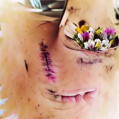 I hope you're feeling better now