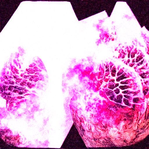 lungs-in-a-box
