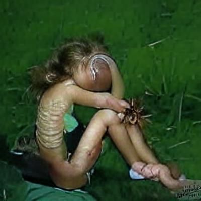 The worm girl