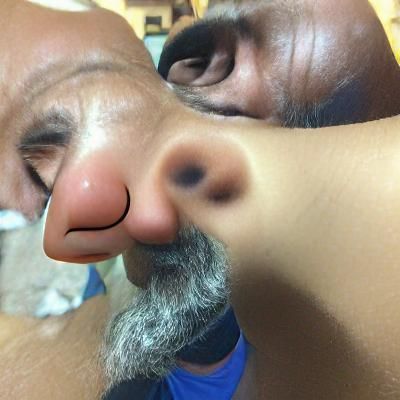 My uncle stole my nose