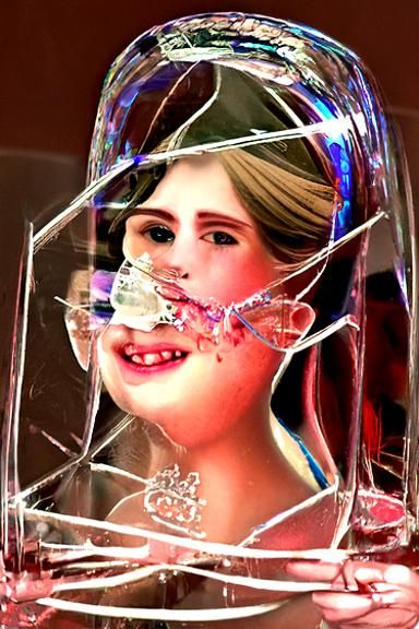 Beautiful princess disease
