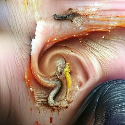 Worm inside of ear