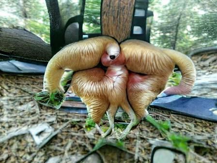 Conjoined twins