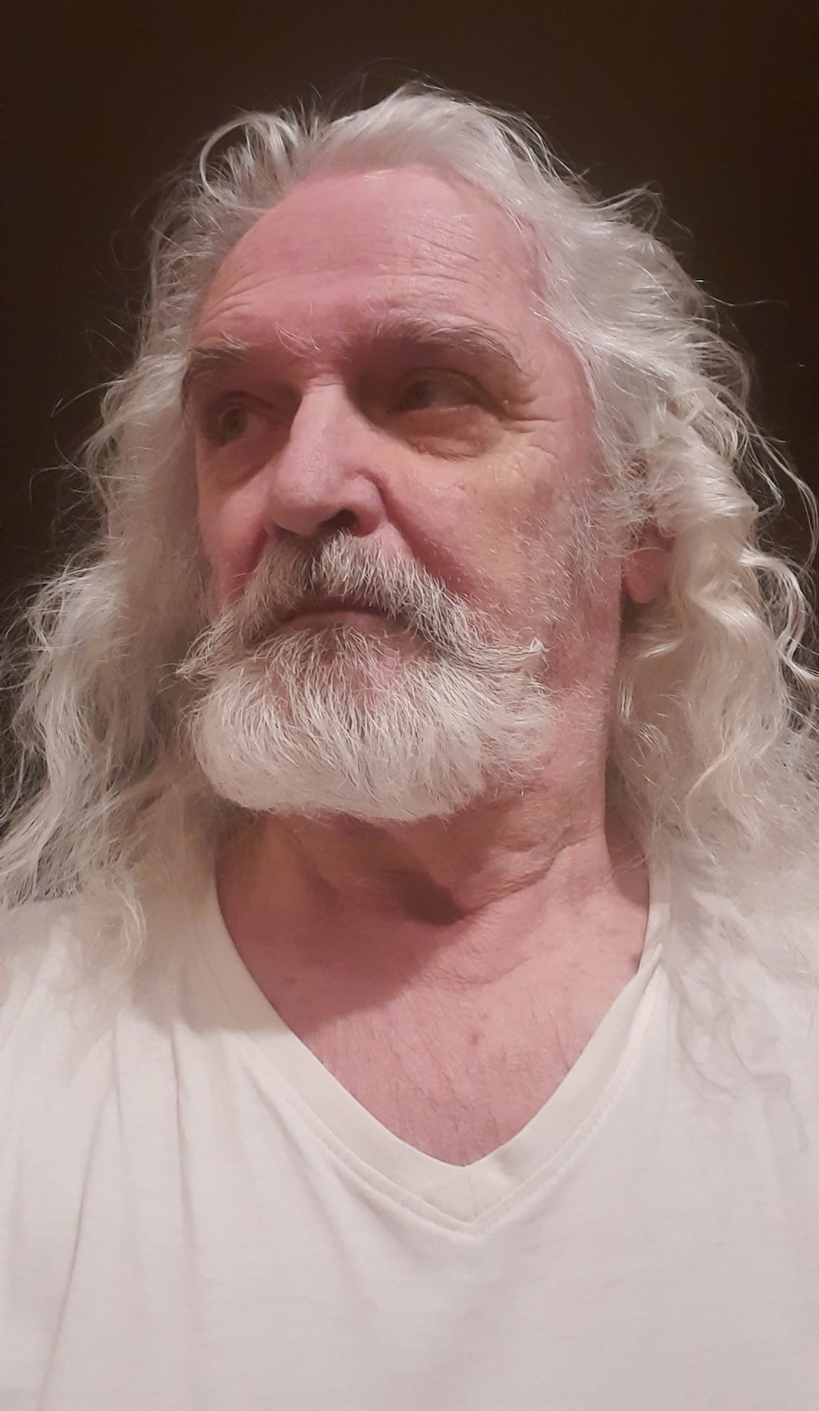 MY ALLERGIES ARE COMING OUT