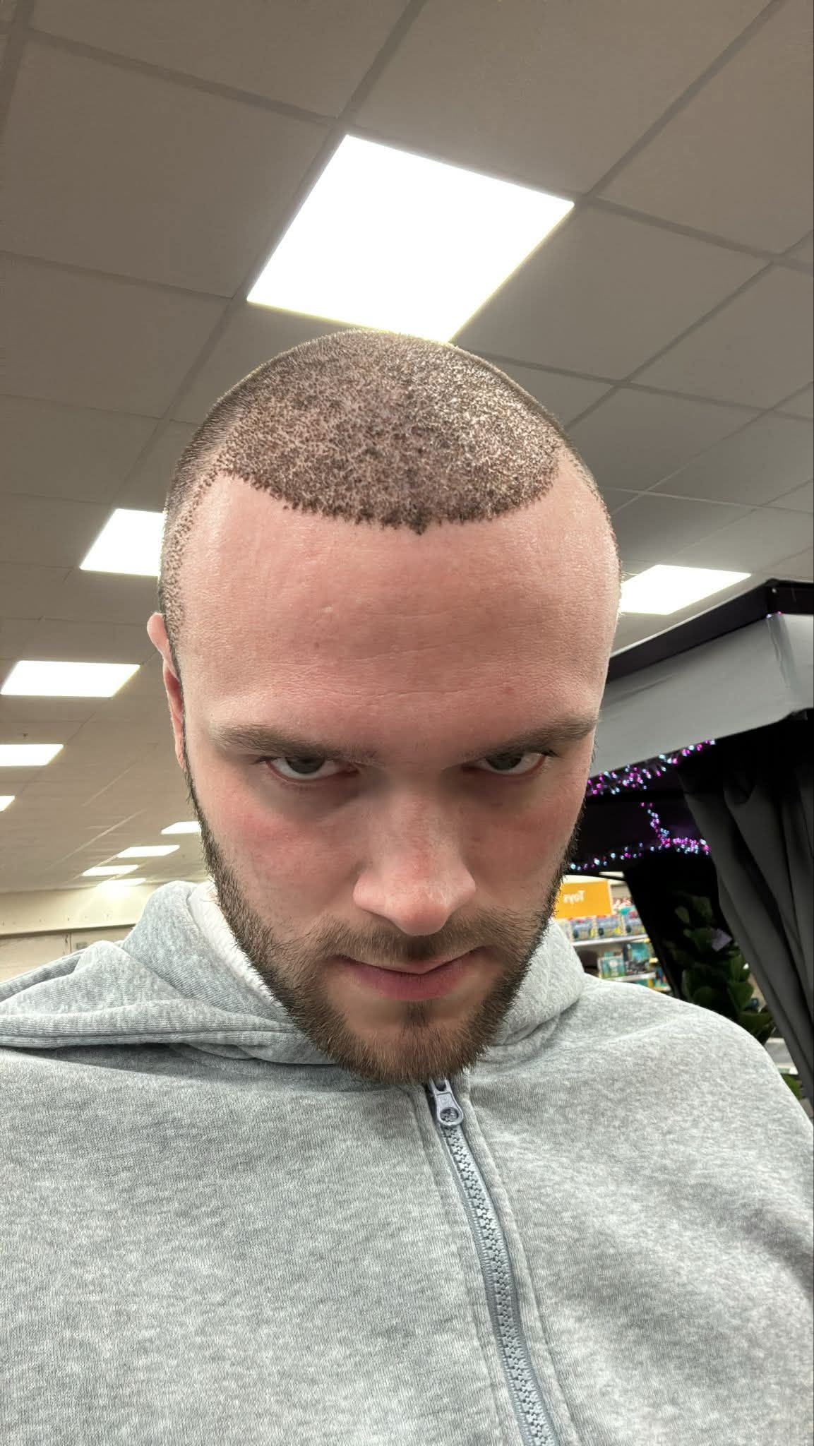 The man's head cracks open like an egg and a baby chicken pops out